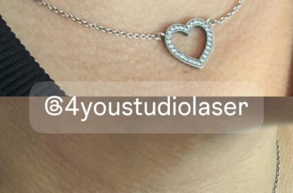✨4 You Studio Láser✨